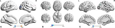 Effects of the DRD4 −521 C/T SNP on Local Neural Activity and Functional Connectivity in Children With ADHD